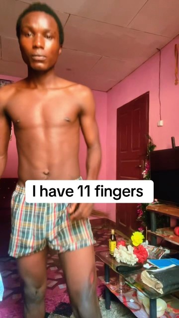 I have 11 fingers