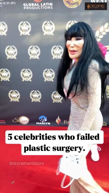 5 Celebrities who failed plastic surgery